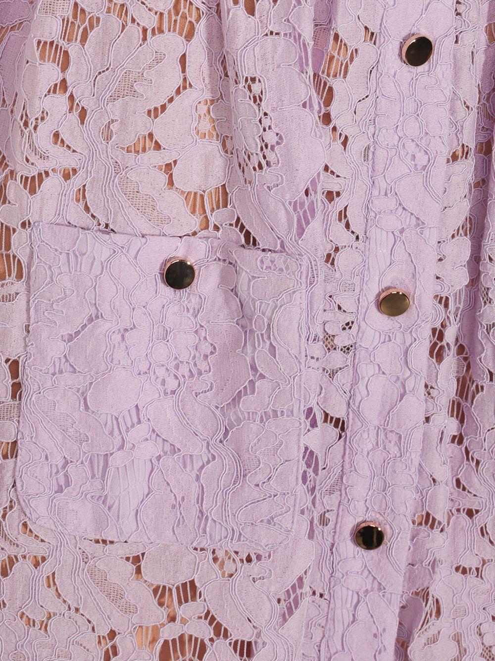 lace button-up midi dress Product Image